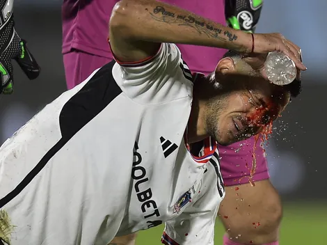 Salió ensangrentado: Ramiro se pronuncia tras doloroso accidente ante Central