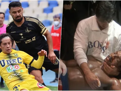 Hinchas echan a volar su imaginación tras ver a Colo Colito goleado