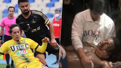 ¿Se dará la "venganza" del Cacique por la goleada de Colo Colito?