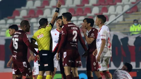 El Mati fue expulsado ante Curicó Unido.