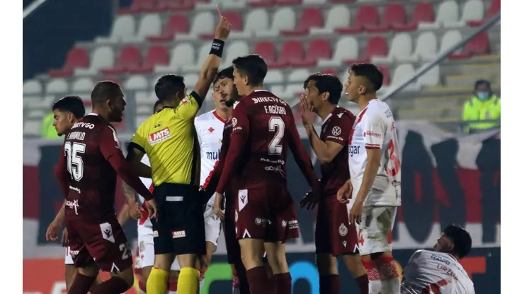 El Mati fue expulsado ante Curicó Unido.