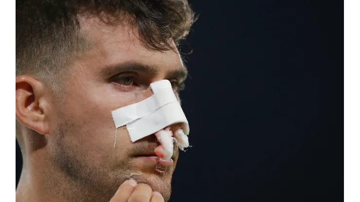 Así quedó el rostro de César Fuentes tras recibir el fuerte codazo de Ariel Martínez.