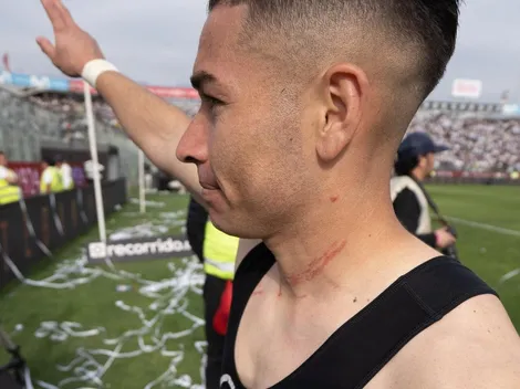 Rasguñado, pero feliz: así salió de la cancha el Torta Opazo en el clásico