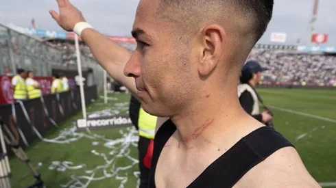 Así terminó Óscar Opazo el superclásico 186.