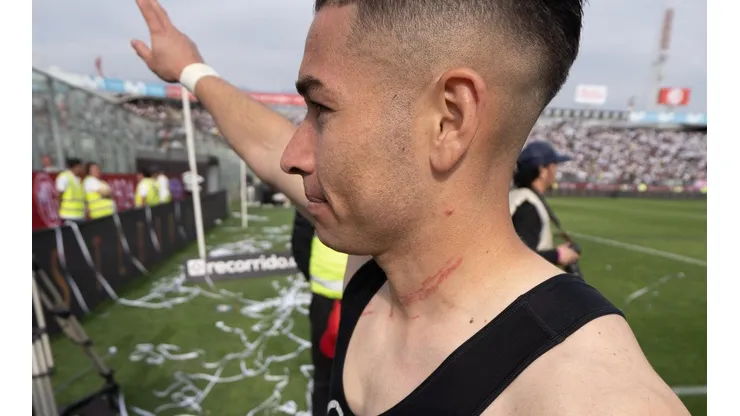 Así terminó Óscar Opazo el superclásico 186.