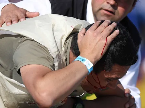 FOTOS | Fotógrafo de Colo Colo recibió proyectil y le tuvieron que poner puntos