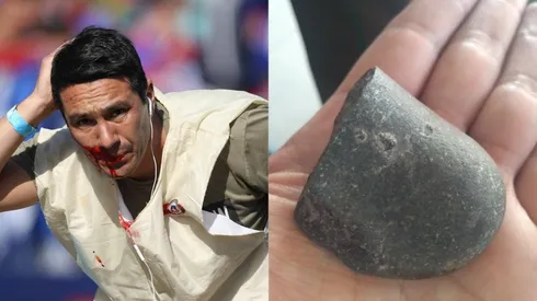 Piedra con filamento terminó impactando al fotógrafo Carlos Succo
