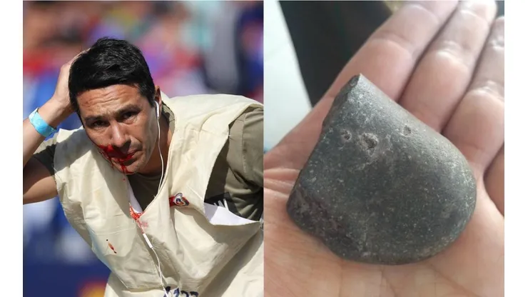 Piedra con filamento terminó impactando al fotógrafo Carlos Succo