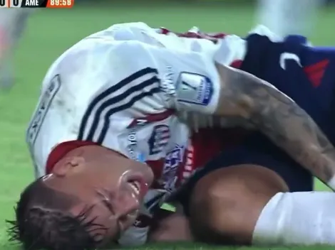 ¡Qué dolor! Paiva sufre grave lesión tras brutal patada en Colombia