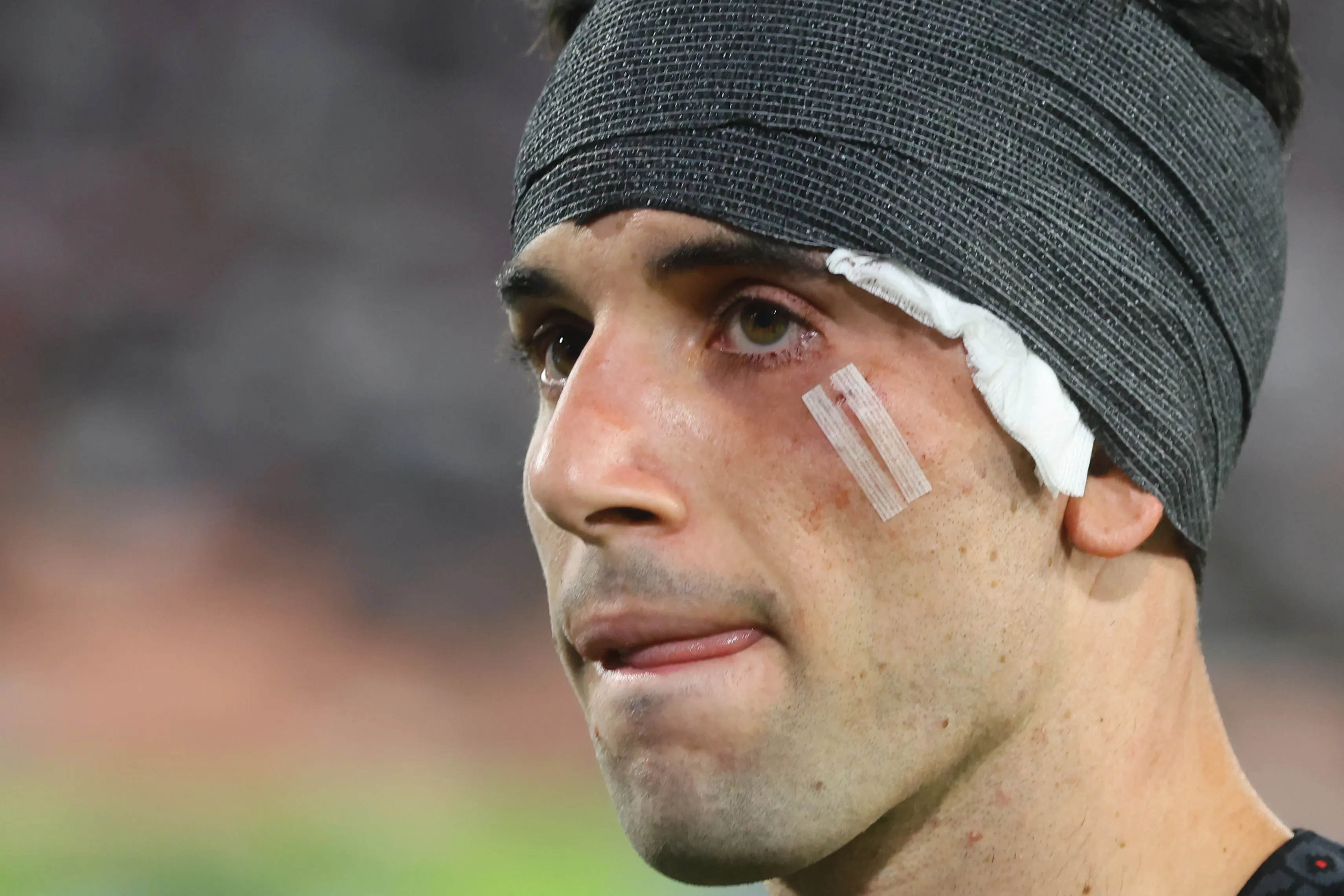 Lautaro Pastrán recibió un fuerte planchazo en el rostro en el amistoso ante Unión Española. 