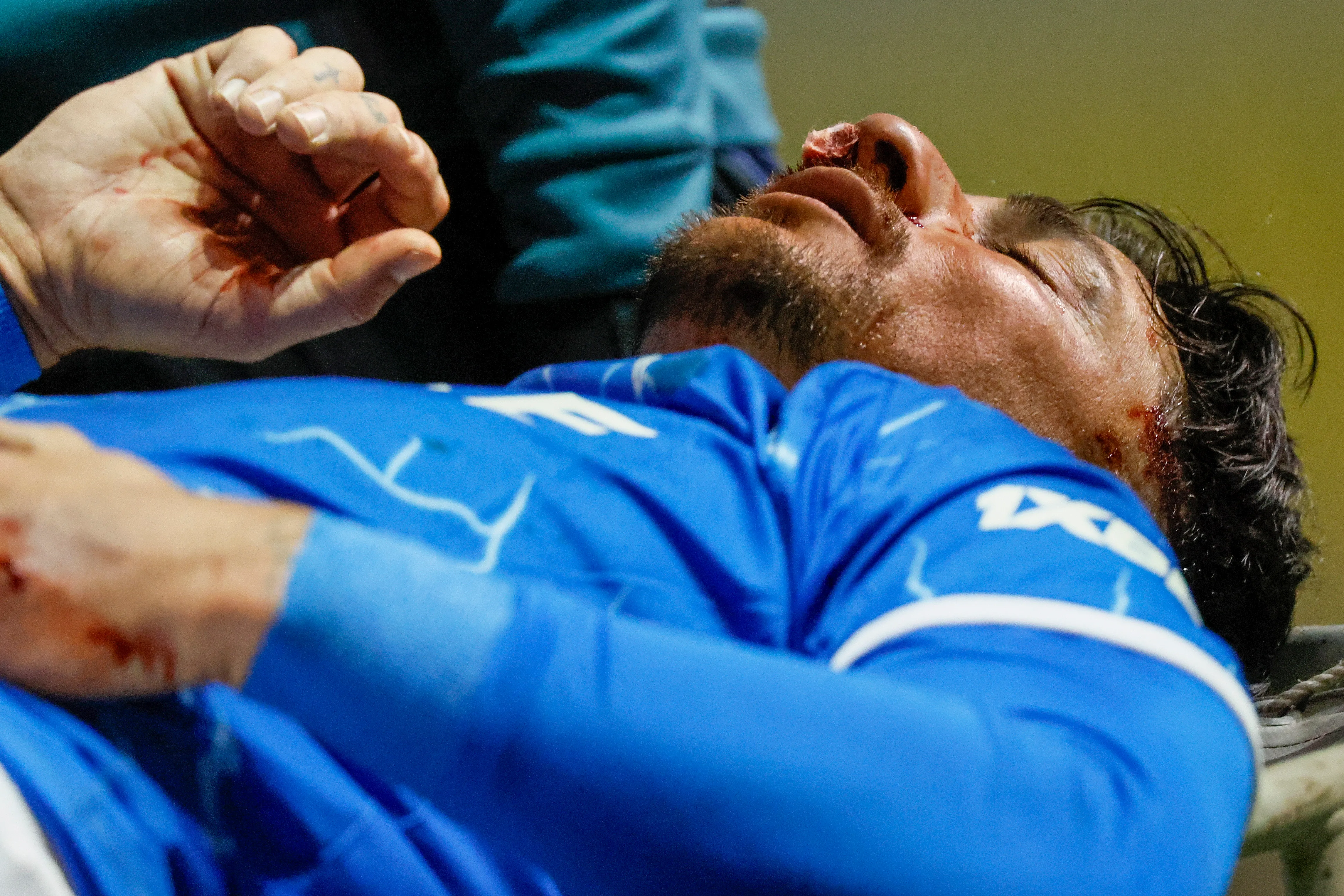 Fernando Zampedri sufrió una fractura nasal y es duda para el clásico ante el Cacique en el Claro Arena. Foto: Photosport.