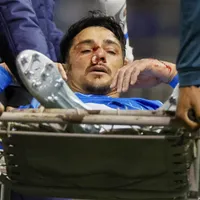Fernando Zampedri enciende las alarmas en la UC de cara al clásico ante Colo Colo