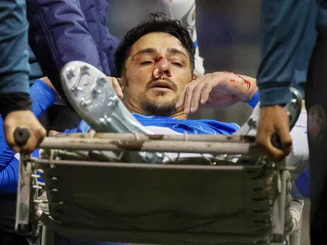 Fernando Zampedri enciende las alarmas en la UC de cara al clásico ante Colo Colo
