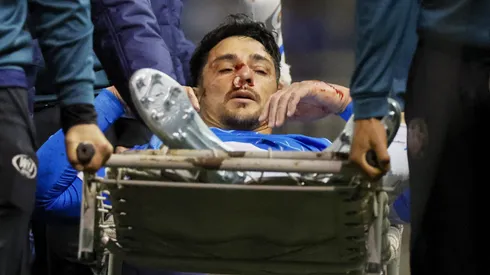 Fernando Zampedri sufre lesión y es duda para enfrentar a Colo Colo.